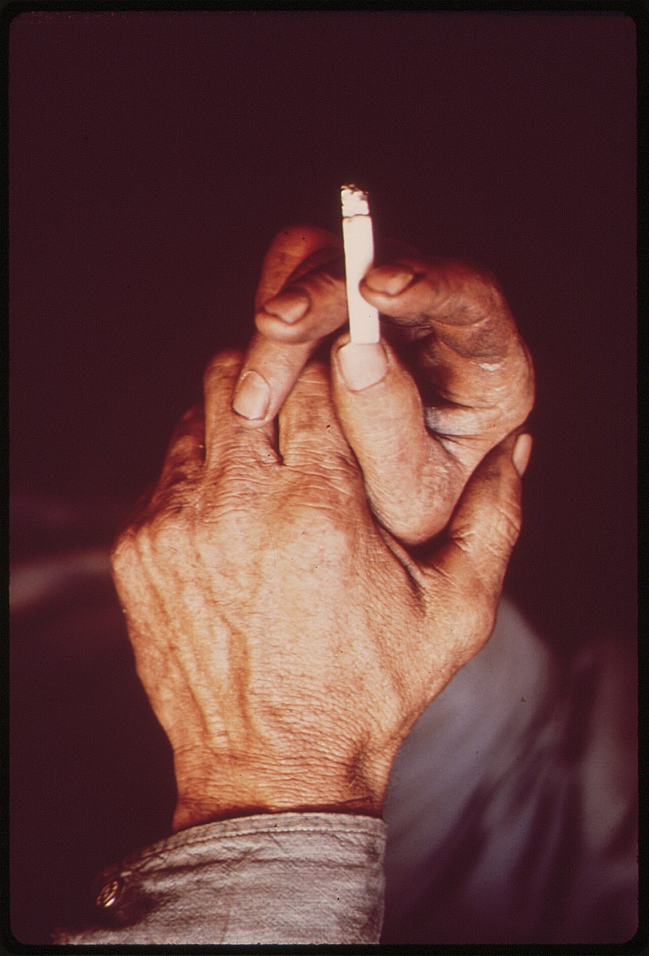 The hands of a uranium miner at rest.
